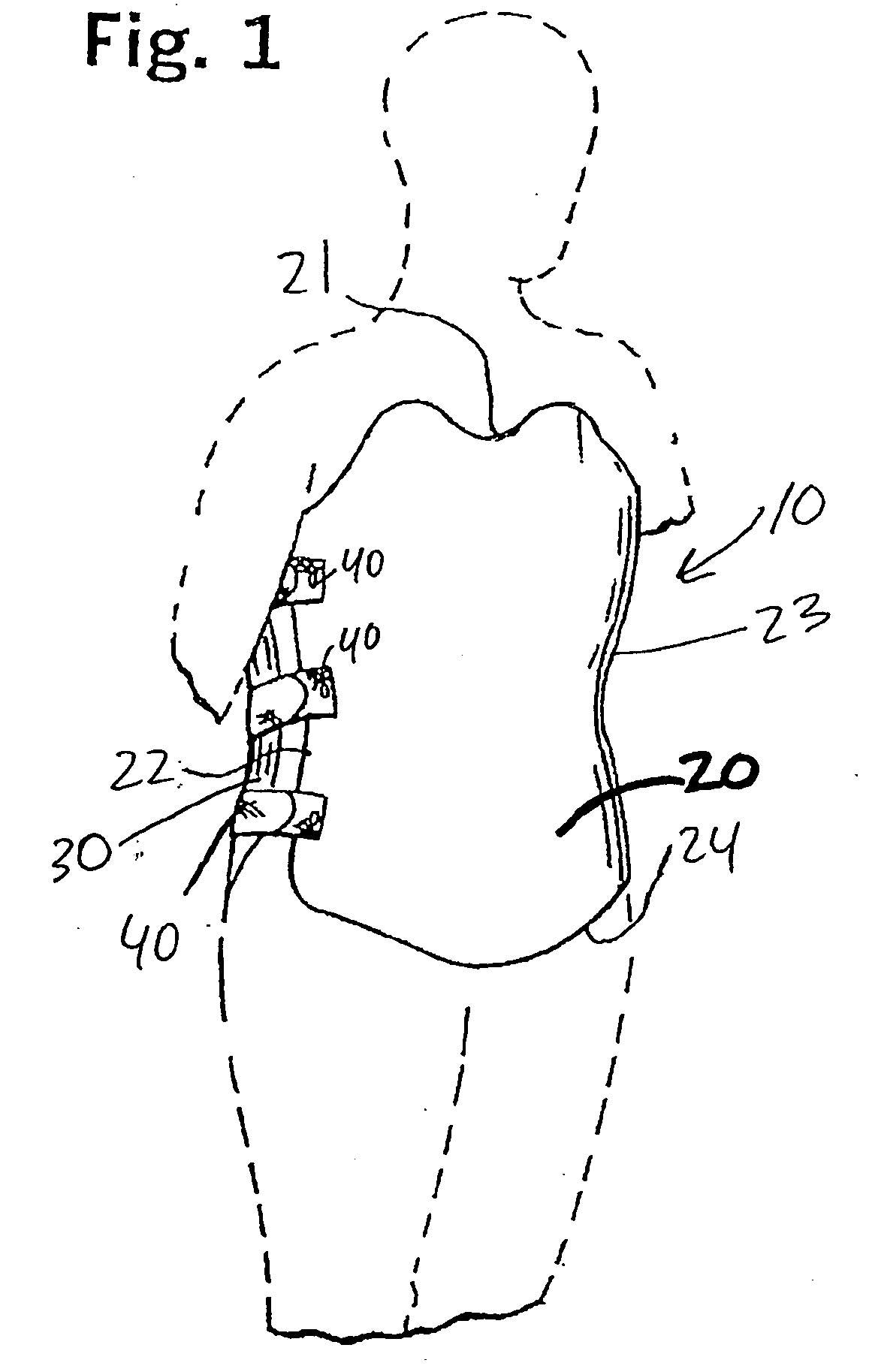 Spinal orthoses