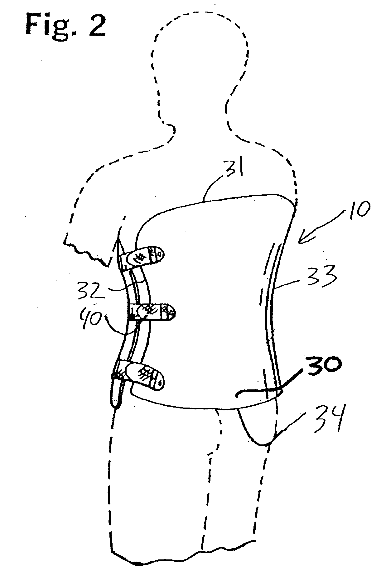 Spinal orthoses