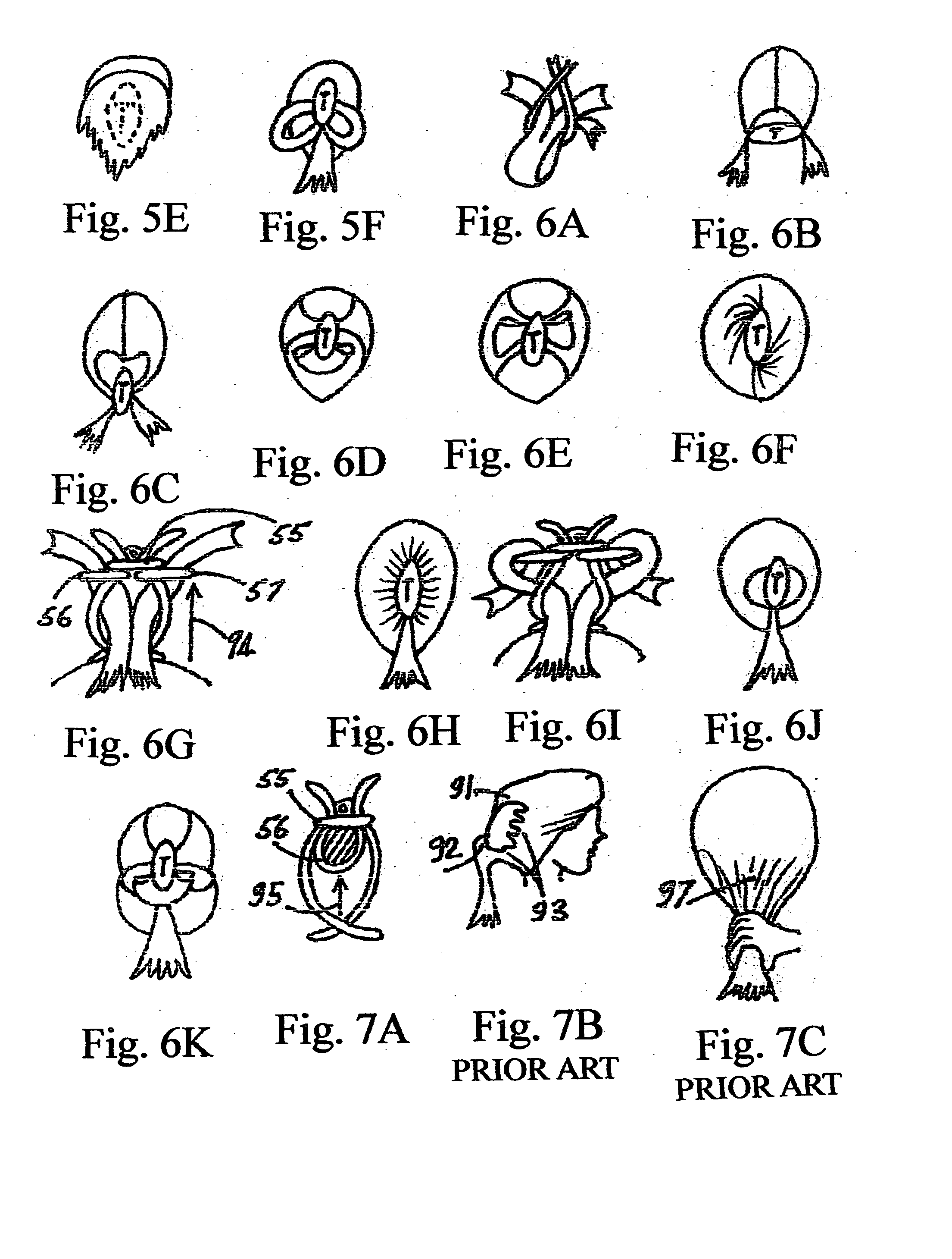 Unique hair-styling system and method