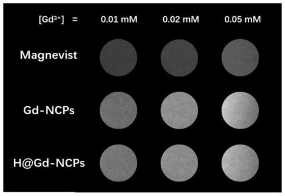 Application of a Nanoscale Coordination Polymer in Nuclear Magnetic Imaging