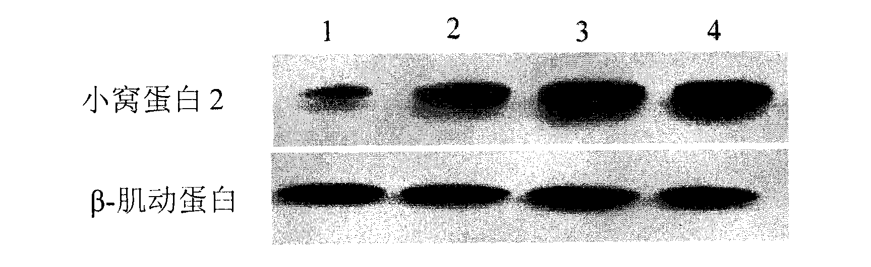 siRNA for inhibiting influenza virus-related gene and application