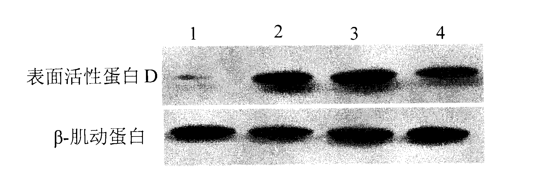 siRNA for inhibiting influenza virus-related gene and application