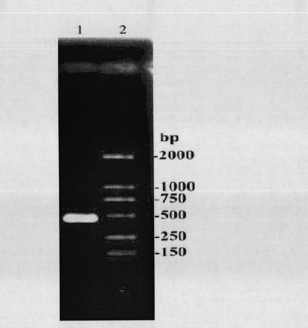 Fermentation medium for preparing recombination IL-1ra (Interleukin-1 Receptor Antagonist) and fermentation method thereof