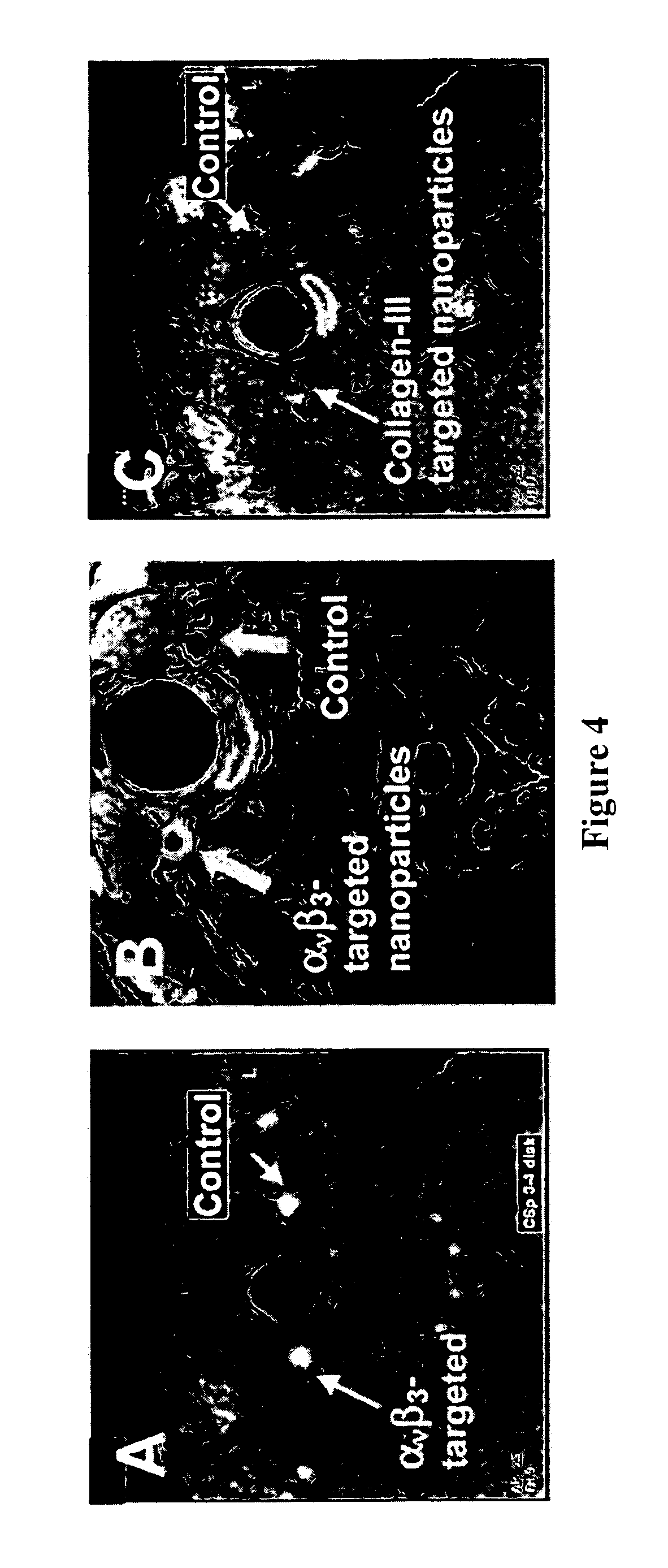 Methods to ameliorate and image angioplasty-induced vascular injury