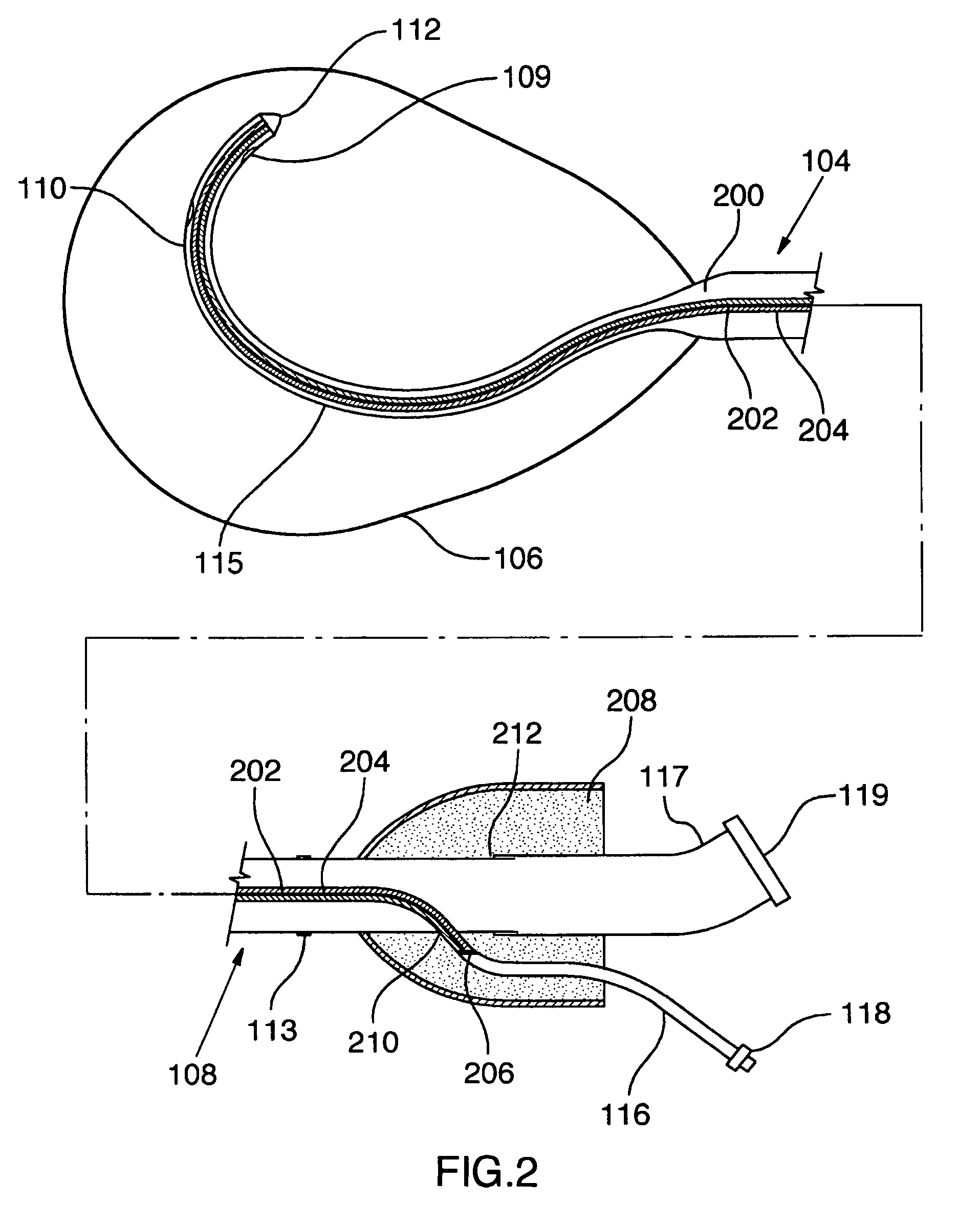 Method of surgical perforation via the delivery of energy