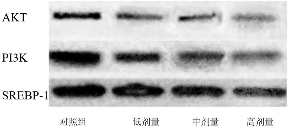 Inhibitor for regulating breast cancer proliferation and migration based on SREBP-1/PI3K/AKT signal channel and application thereof