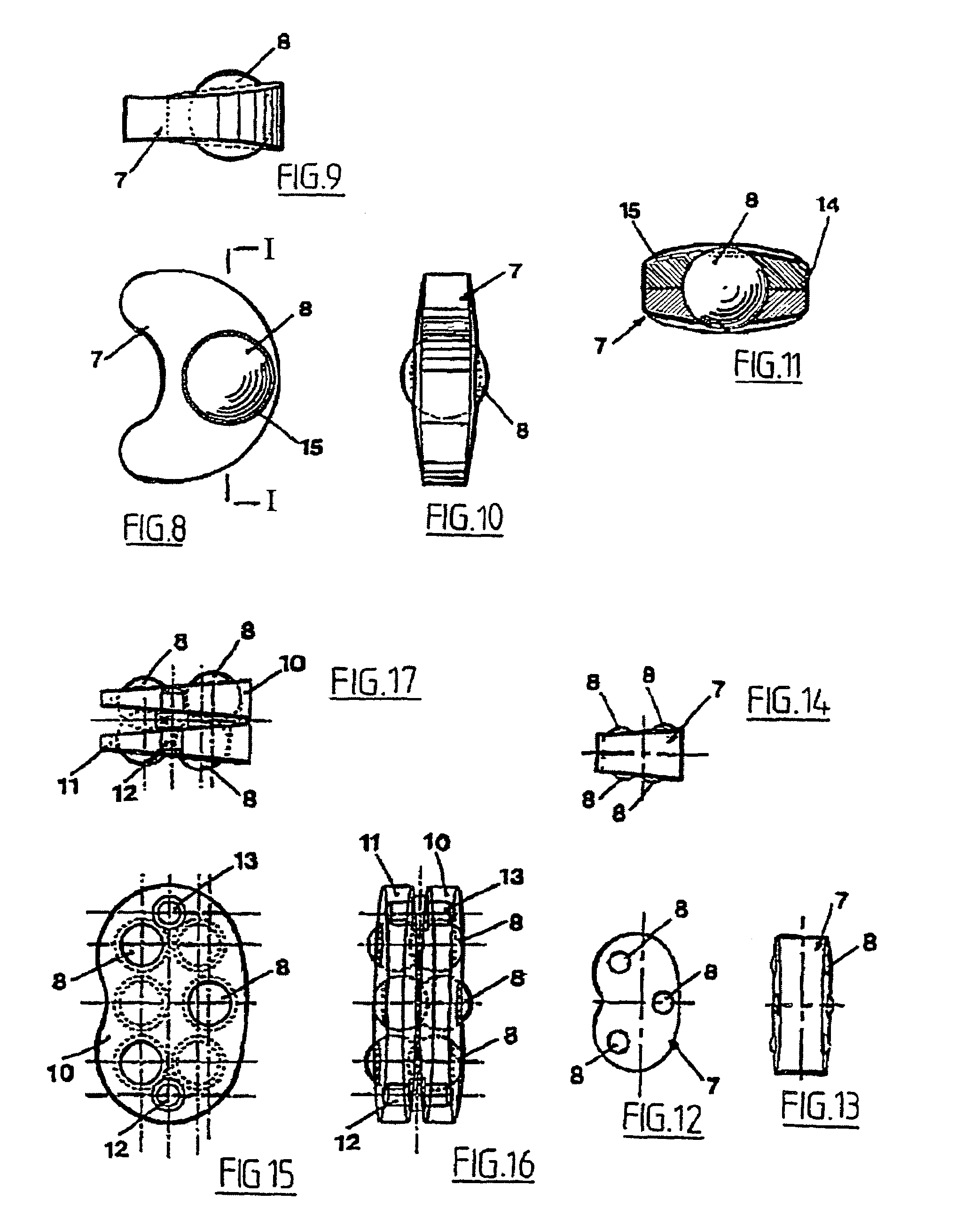 Intervertebral nucleus prosthesis and surgical procedure for implanting the same