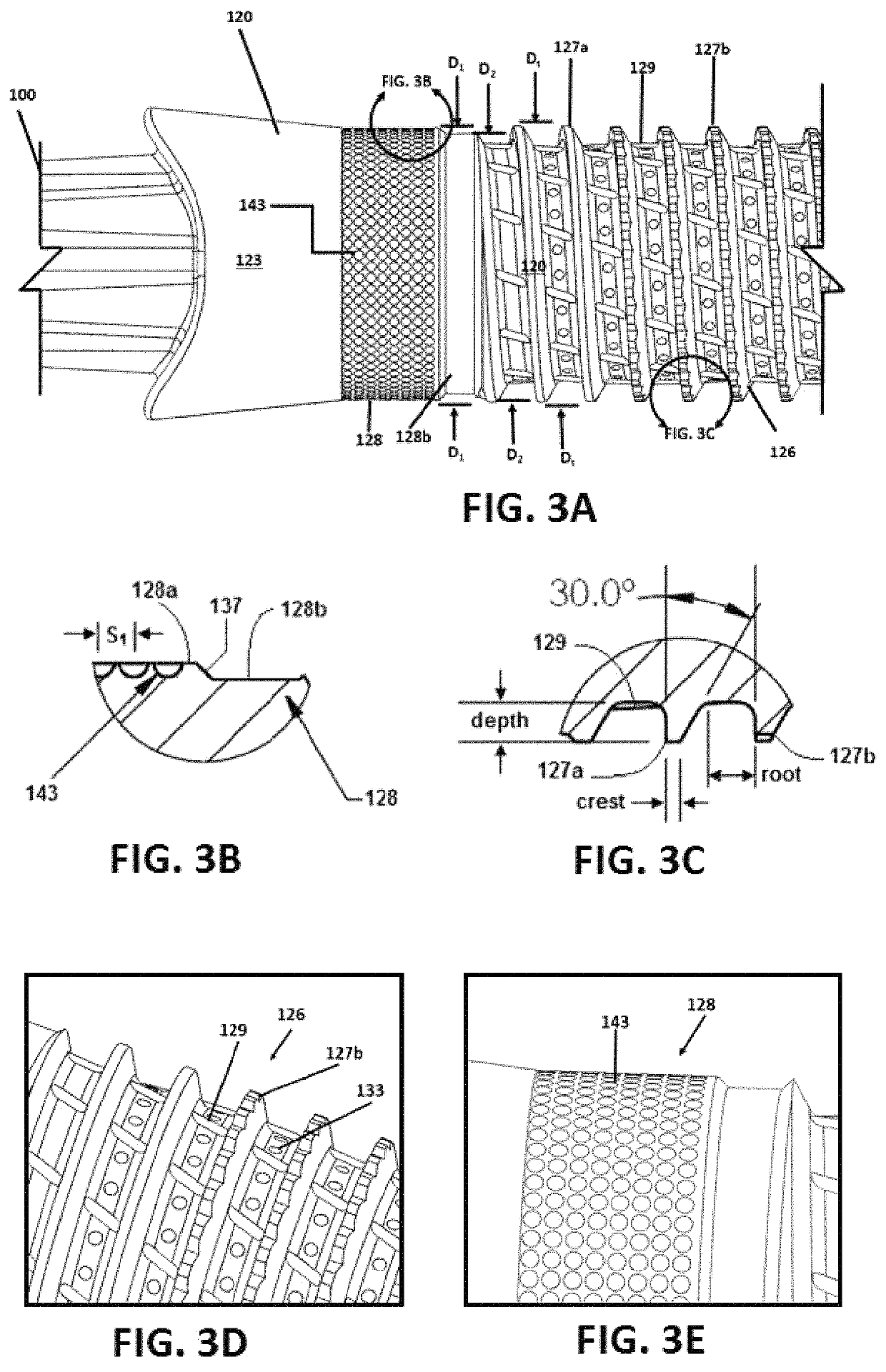 Osseointegrative surgical implant