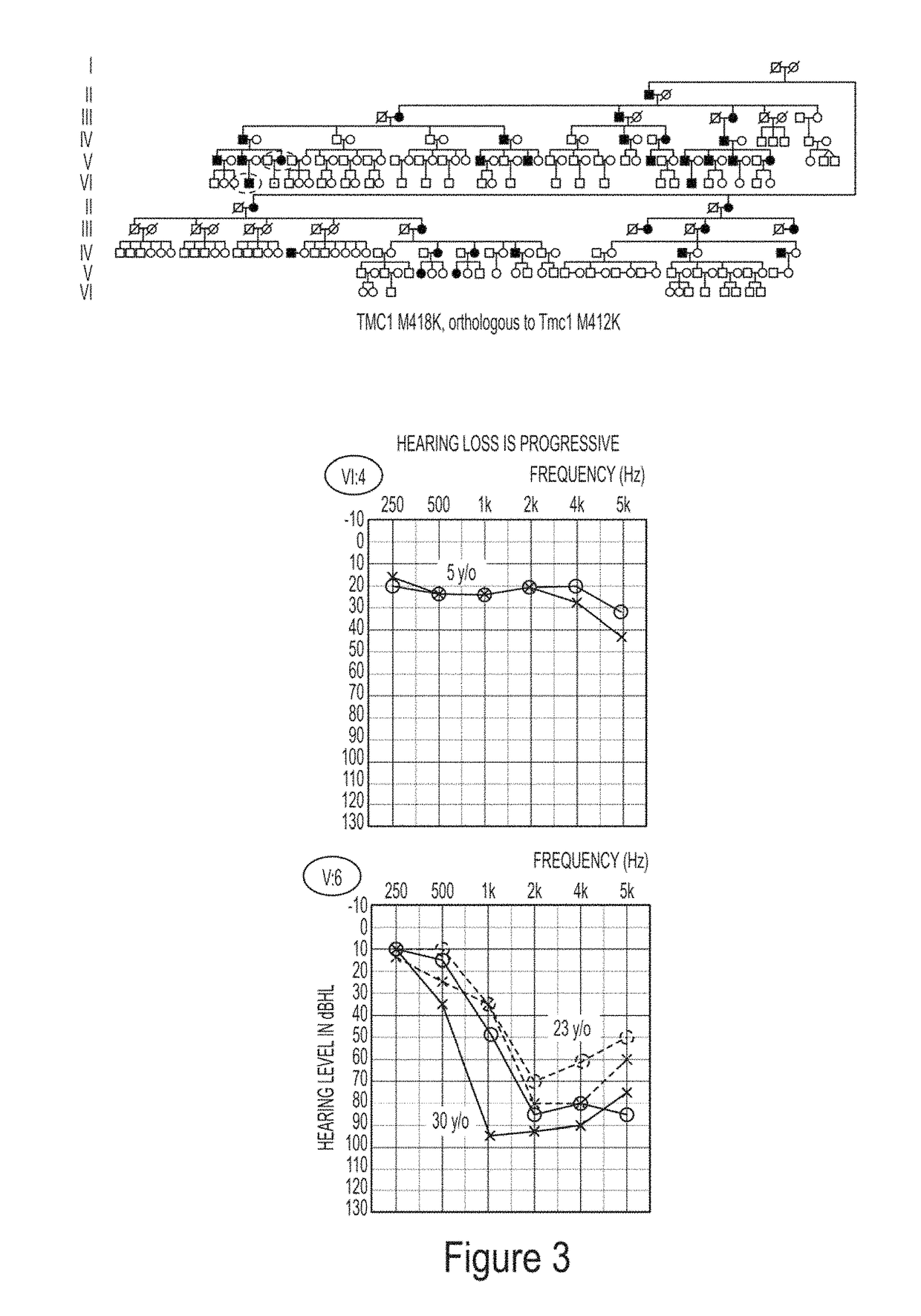 Methods to prevent and treat autosomal dominant non-syndromic hearing loss