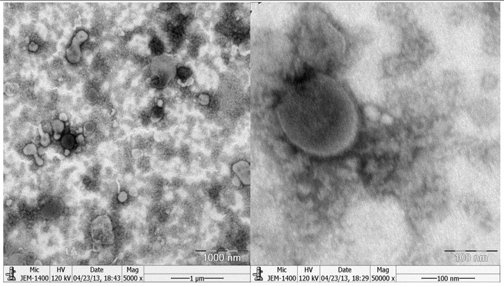 Swine epidemic diarrhea virus and application thereof