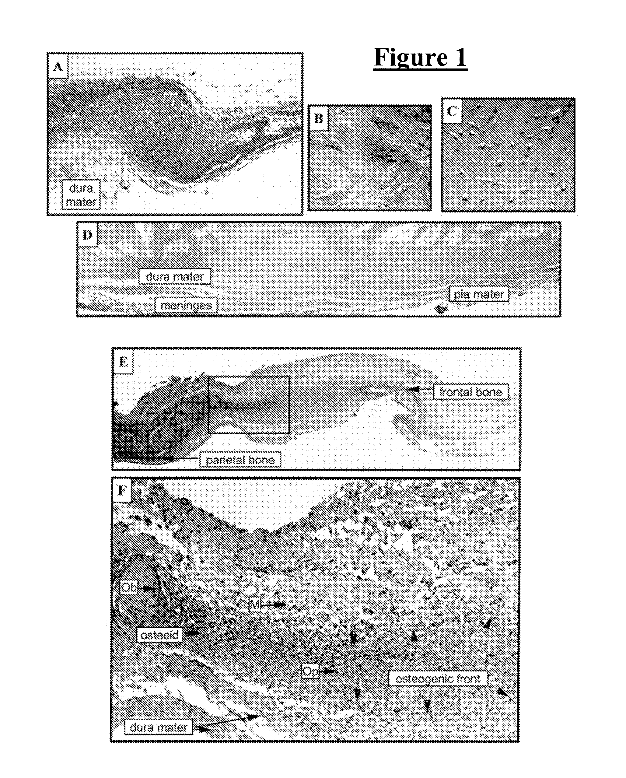 Meningeal-derived stem cells