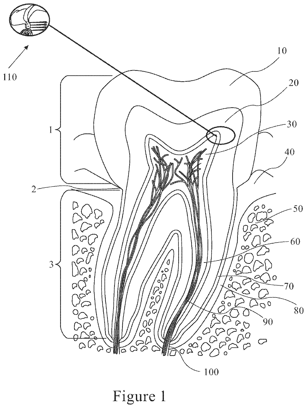 Cannabis and Derivatives Thereof for the Treatment of Pain and Inflammation Related with Dental Pulp and Bone Regeneration Related to Dental Jaw Bone Defects