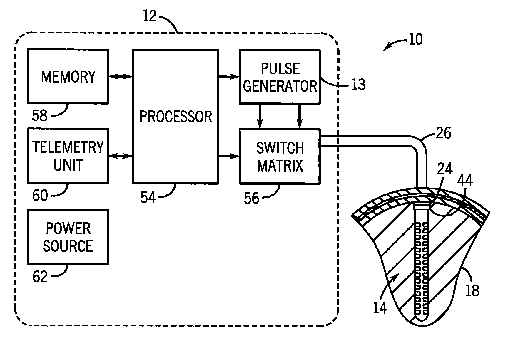 Deep brain stimulation implant with microcoil array