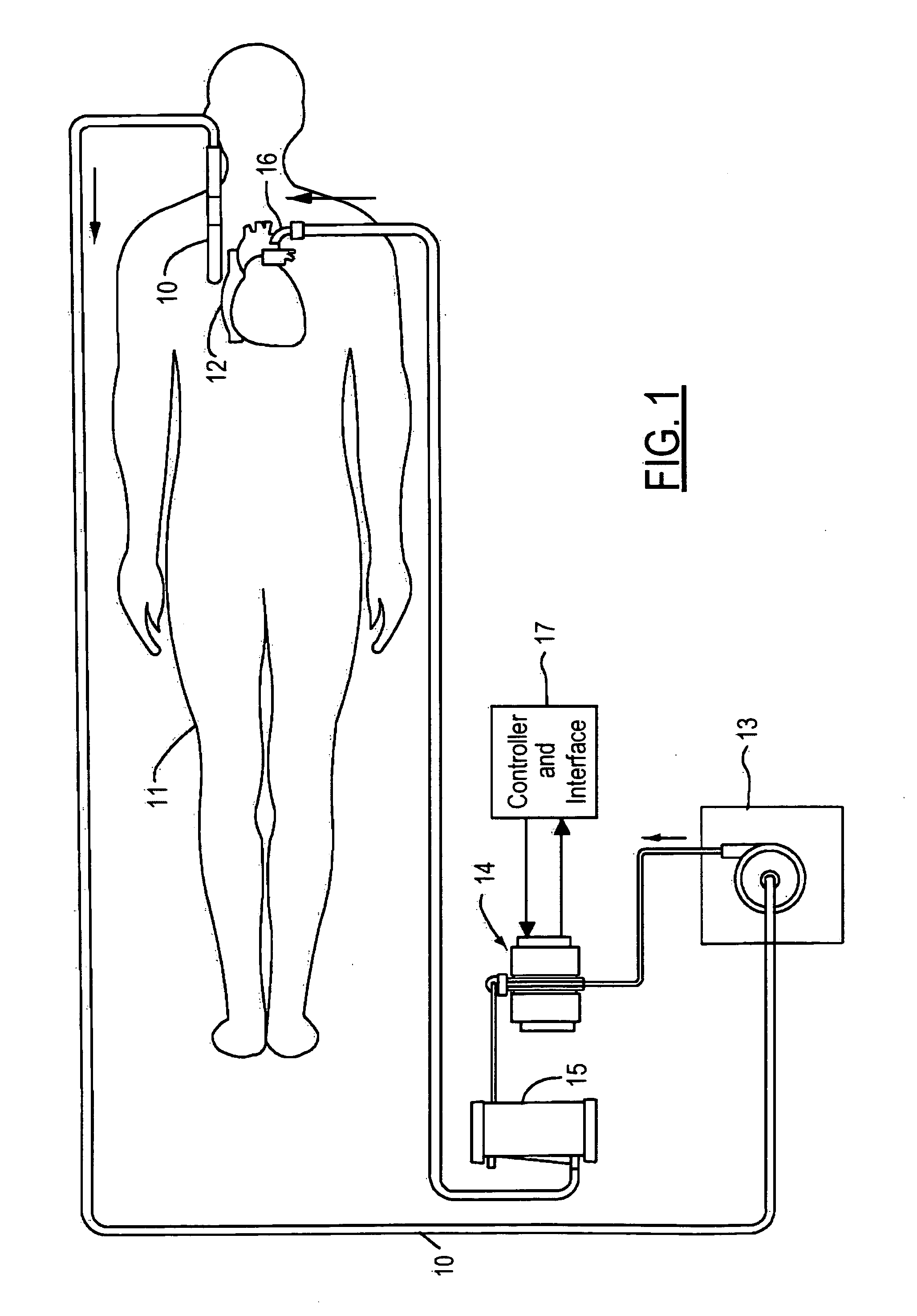 Thermoelectric temperature control for extracorporeal blood circuit