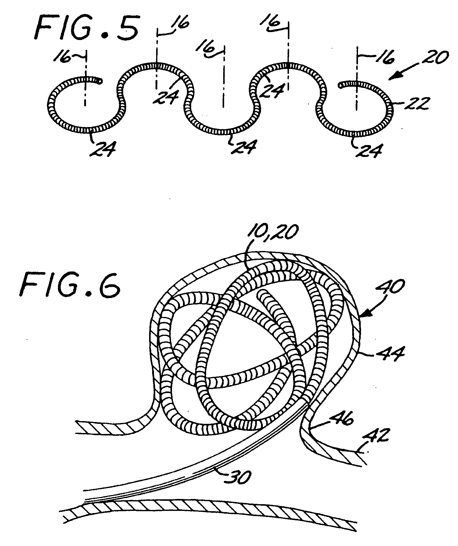 Microcoil vaso-occlusive device with multi-axis secondary configuration