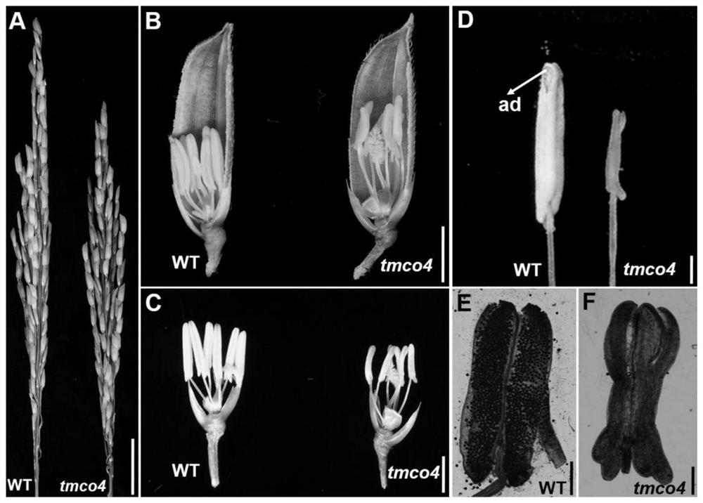 Rice male sterility gene OsLDDT1 and molecular marker and application thereof