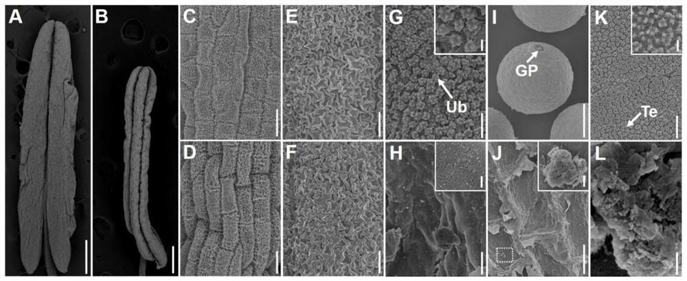 Rice male sterility gene OsLDDT1 and molecular marker and application thereof