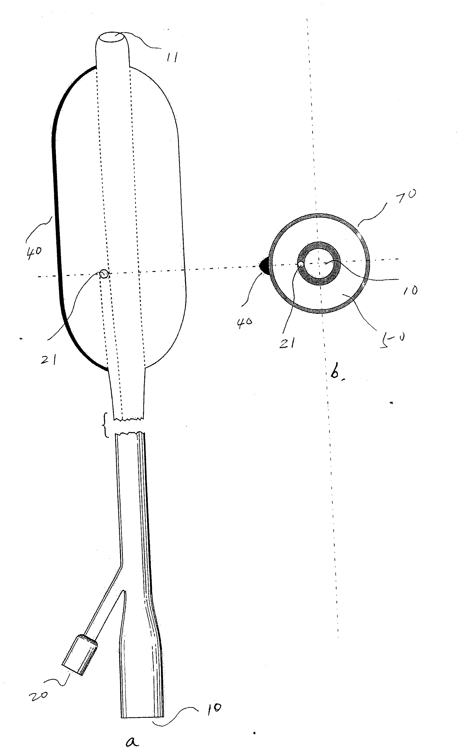 Targeted dilatation forming balloon catheter