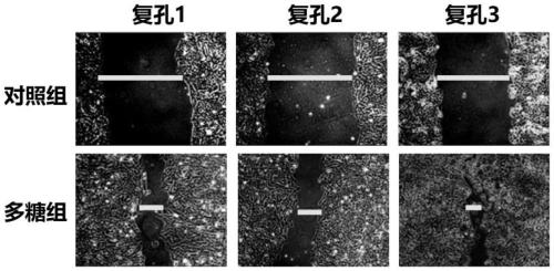 Natural polysaccharide and application in preparation of cosmetics for promoting skin repair and improving skin elasticity