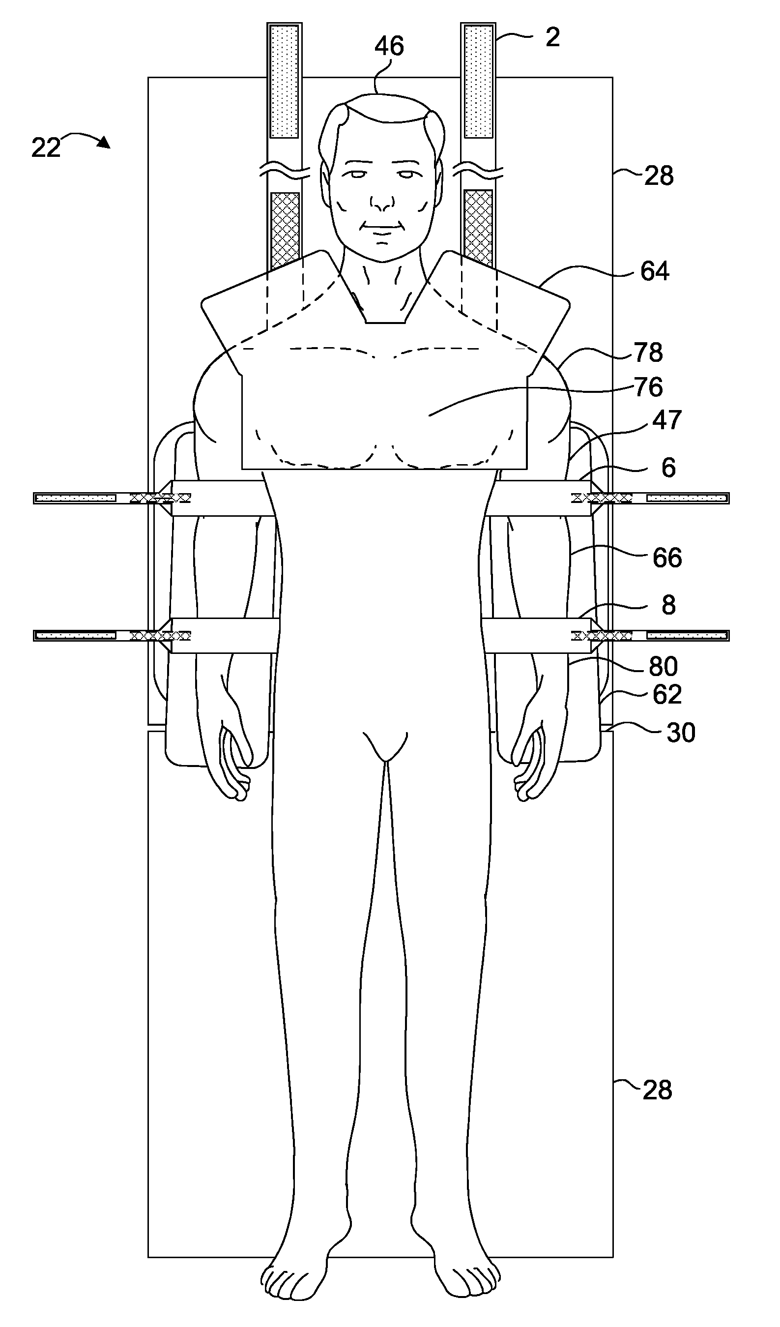 Operating table patient positioner and method