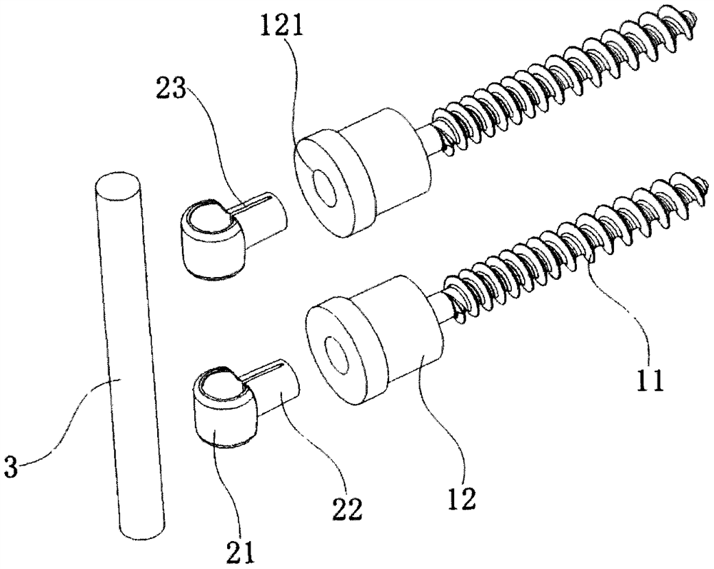 Pedicle screw rod system and manufacturing method thereof