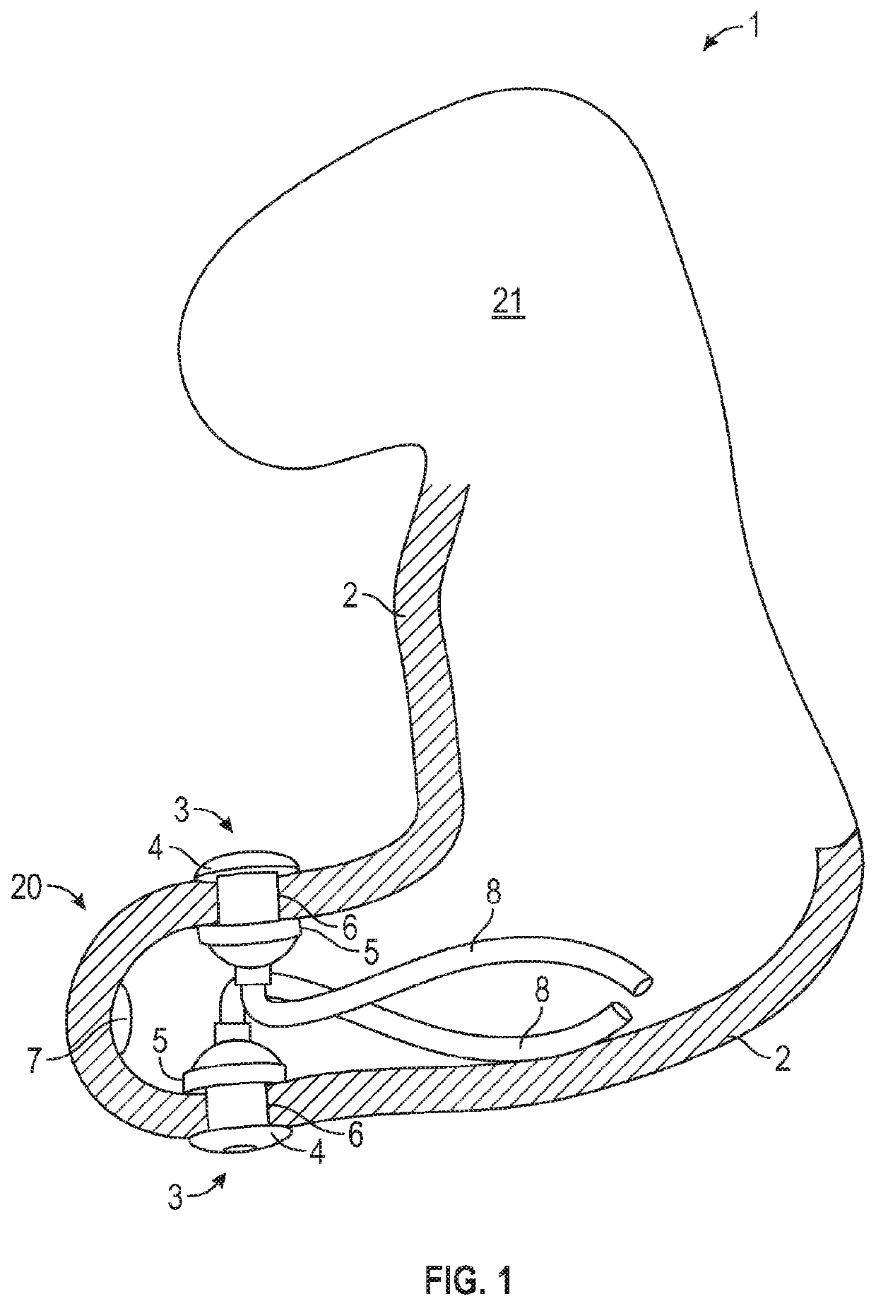 Ear canal plug for detecting bio-electrical signals