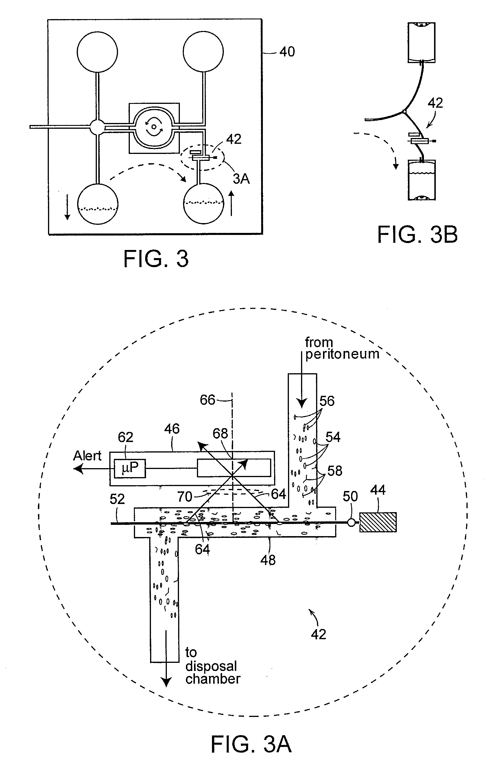 Early stage peritonitis detection apparatus and methods