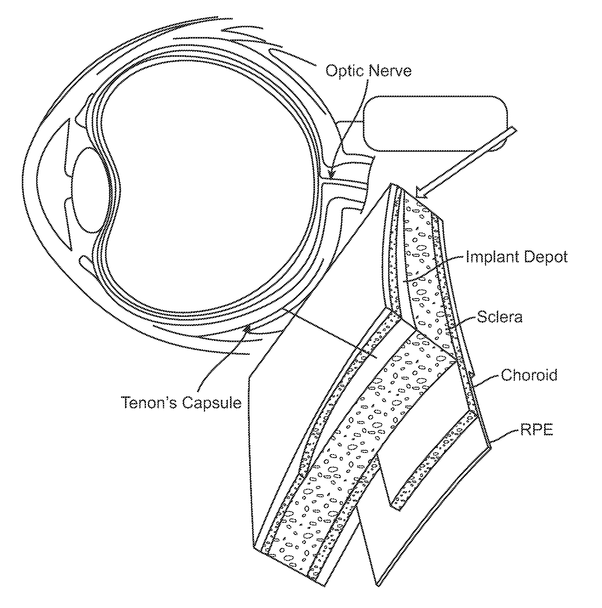 Biodegradable Microspheres and Methods of Use Thereof