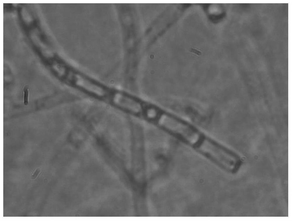 Irpex lacteus capable of efficiently degrading lignin