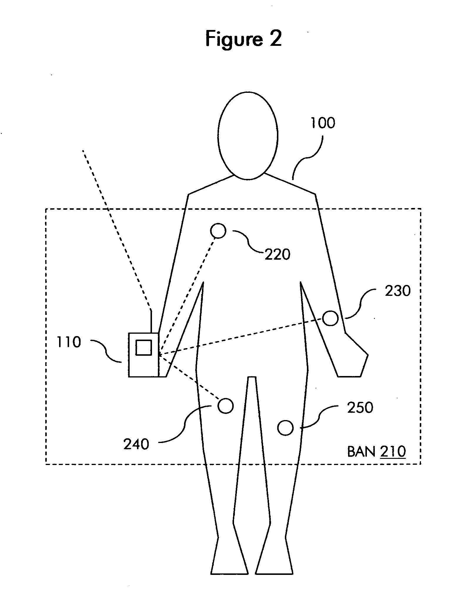 Method and system for self-monitoring of environment-related respiratory ailments