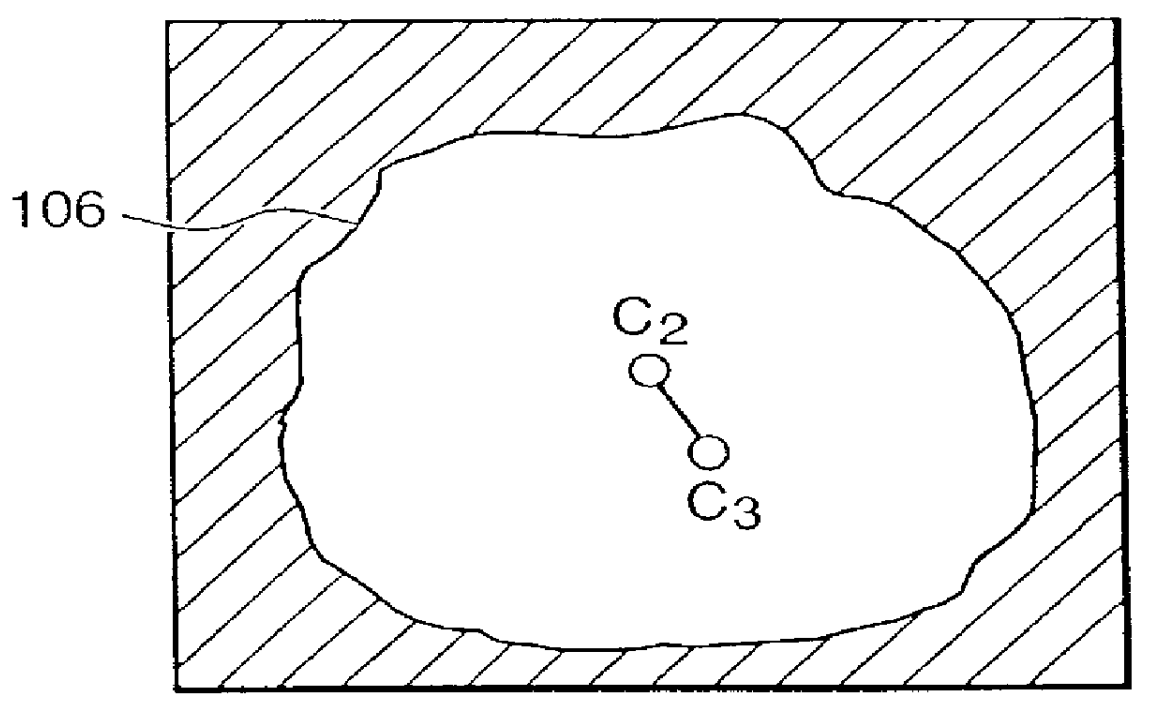 Method and system to enhance robust identification of abnormal regions in radiographs