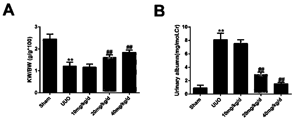 Application of Panax ginseng saponins IVa in the preparation of medicines for treating nephritis or renal fibrosis