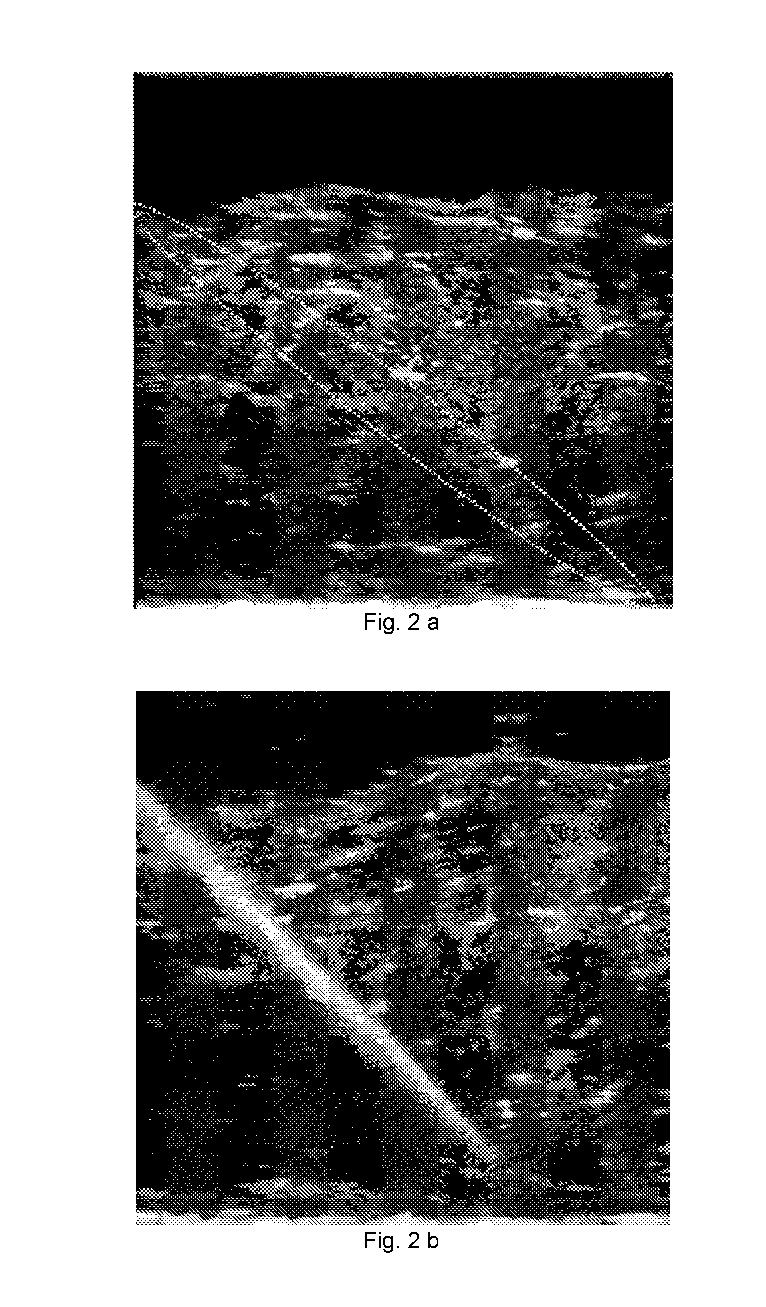 Coating for improving the ultrasound visibility