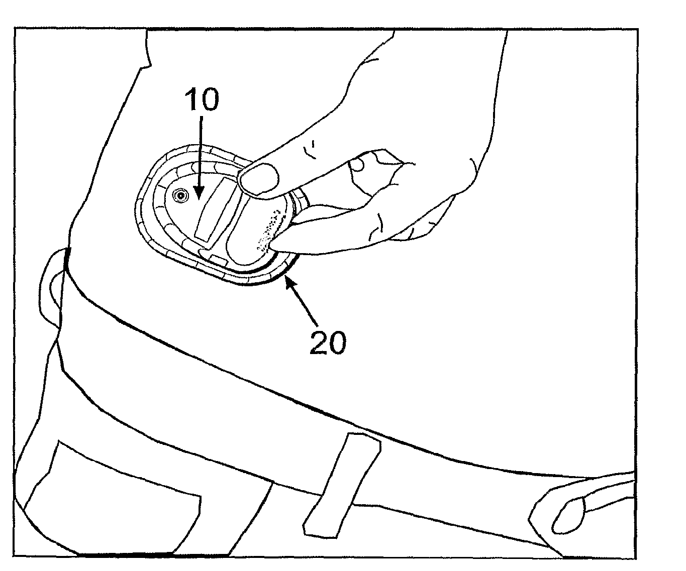 Manually Operable Portable Infusion Device