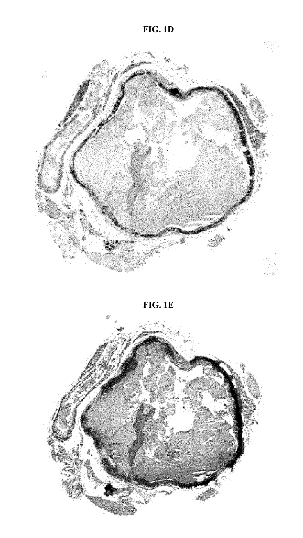 Compositions for Treating Pathological Calcification Conditions, and Methods Using Same