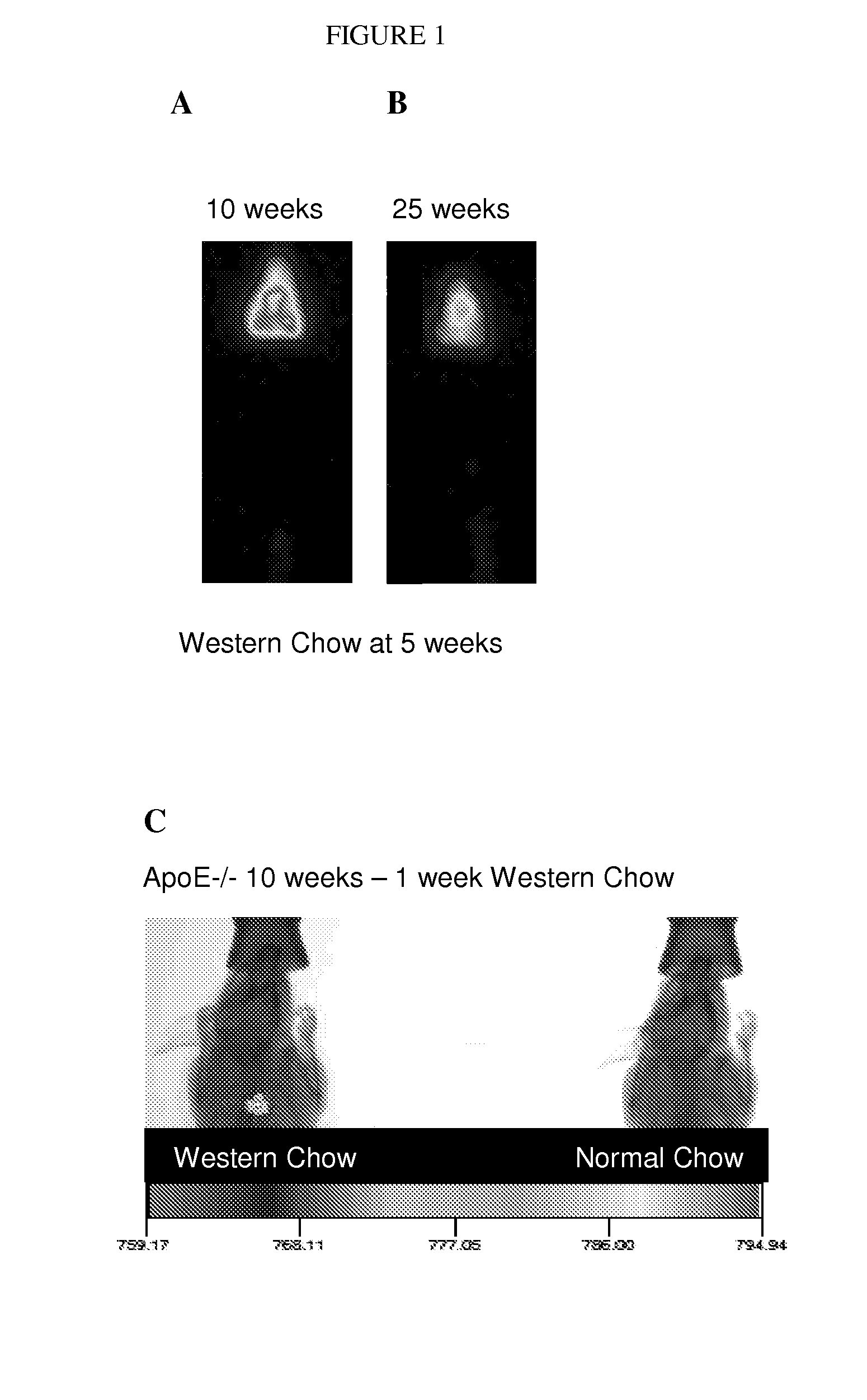 Method for early imaging of atherosclerosis