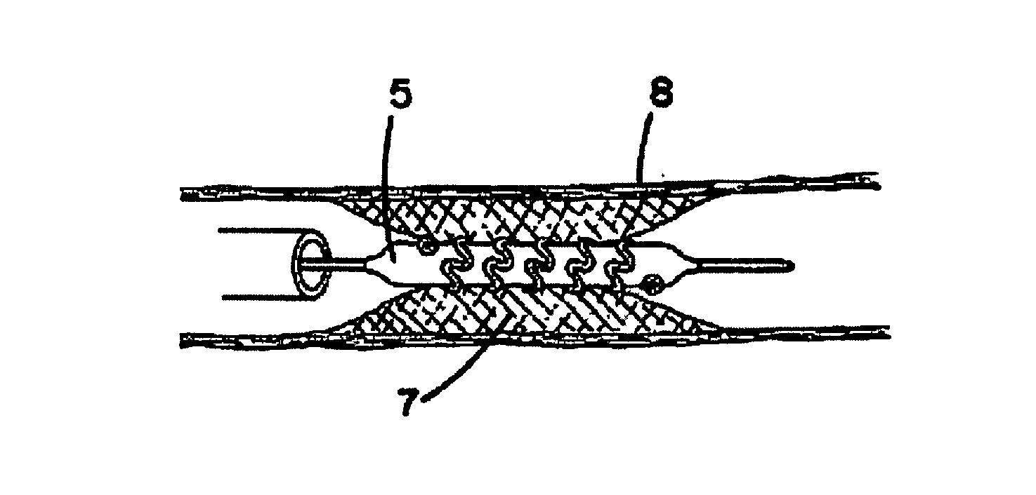 Multigraft Copolymers as Superelastomers