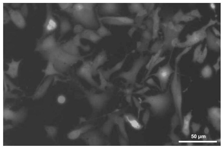 Melanoma leptomeningeal metastasis model construction method