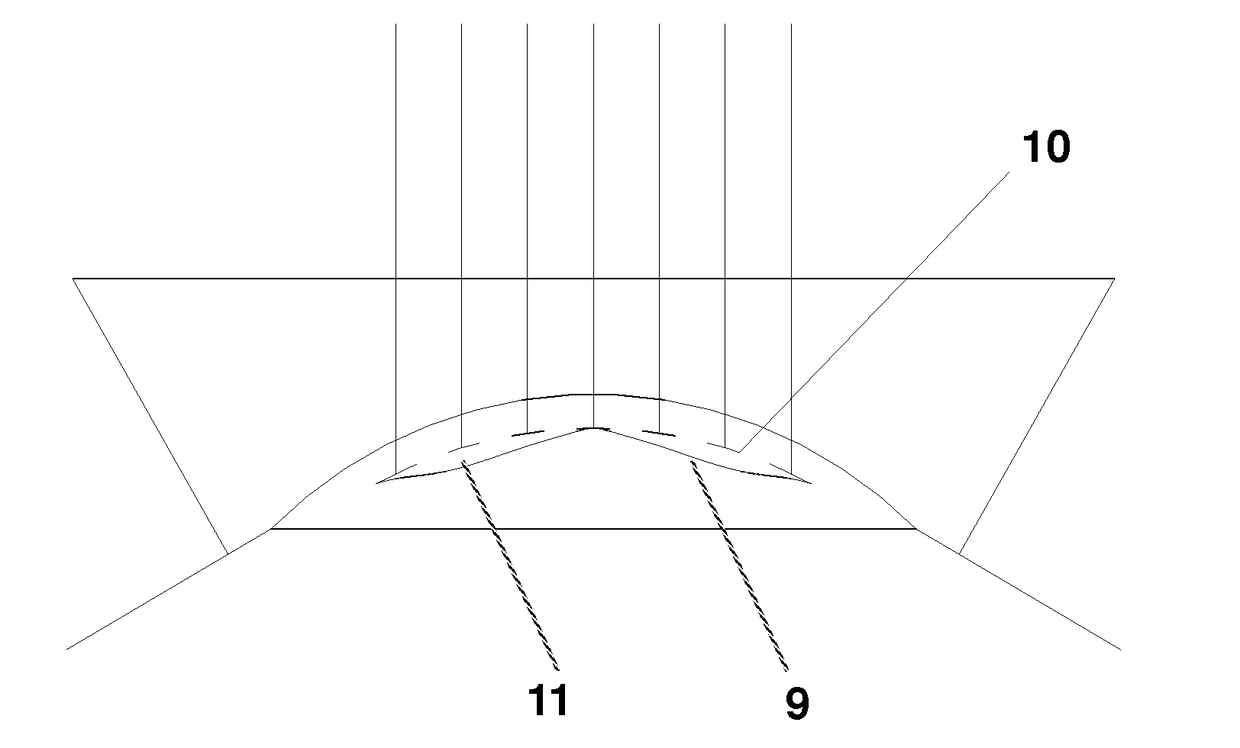 System for Correcting an Irregular Surface of a Cornea and Uses Thereof