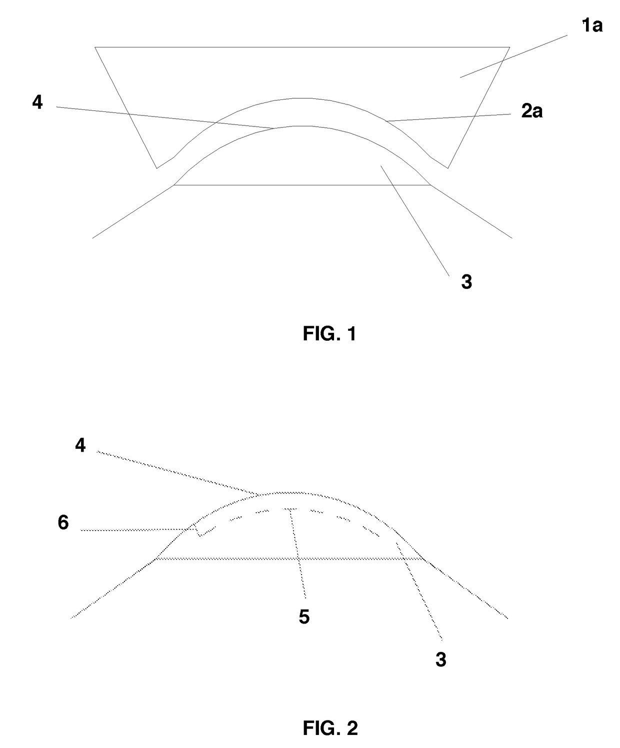 System for Correcting an Irregular Surface of a Cornea and Uses Thereof