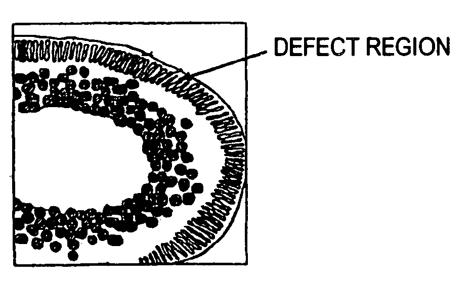 Braid-reinforced hollow fiber membrane