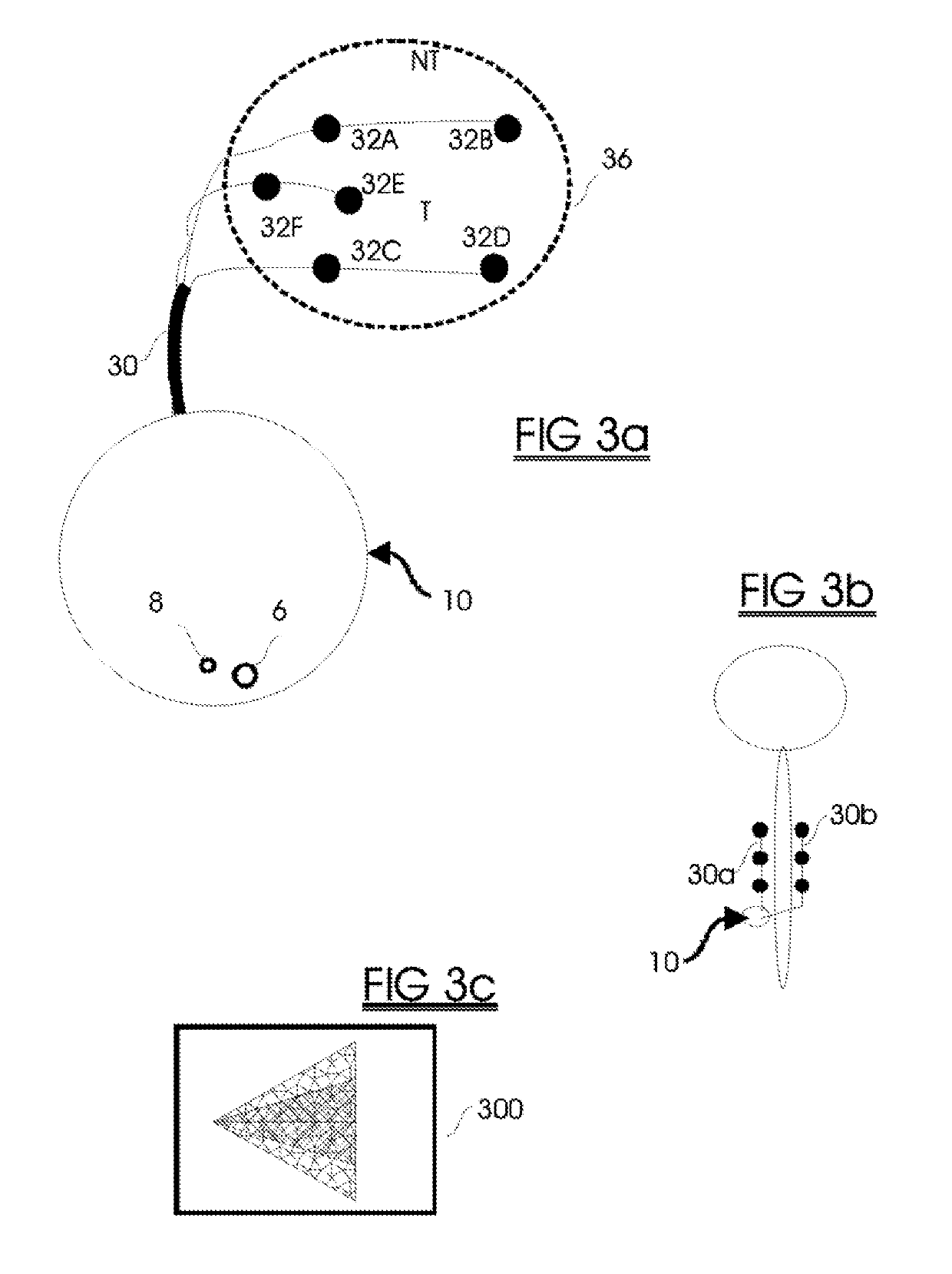 Systems and Methods for Improved Spinal Cord Stimulation