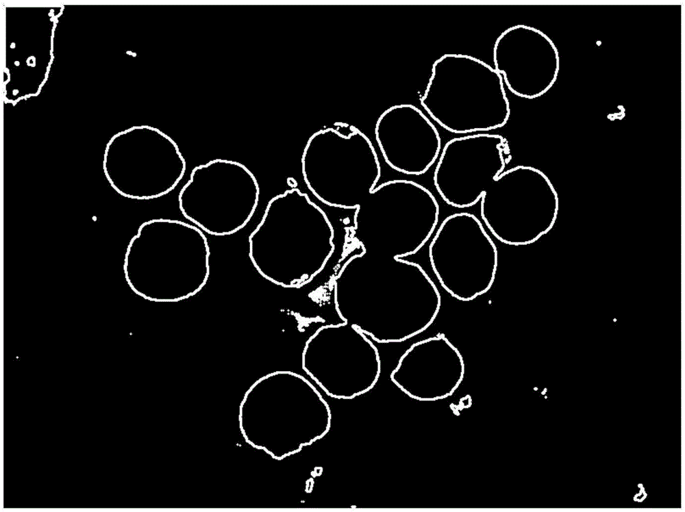 Marrow fluid cell partition method based on depth study