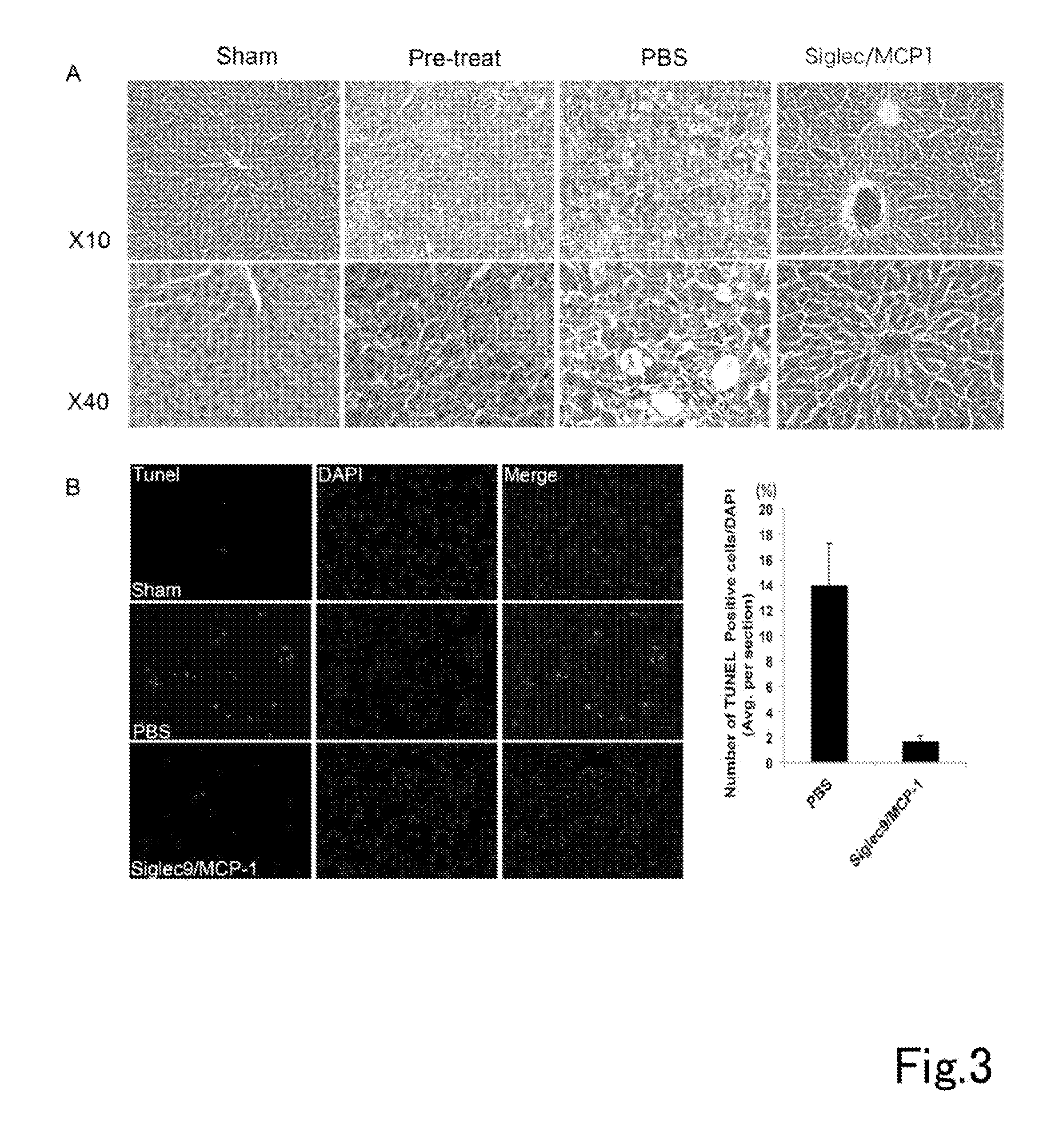 Composition having tissue-repairing activity, and use therefor