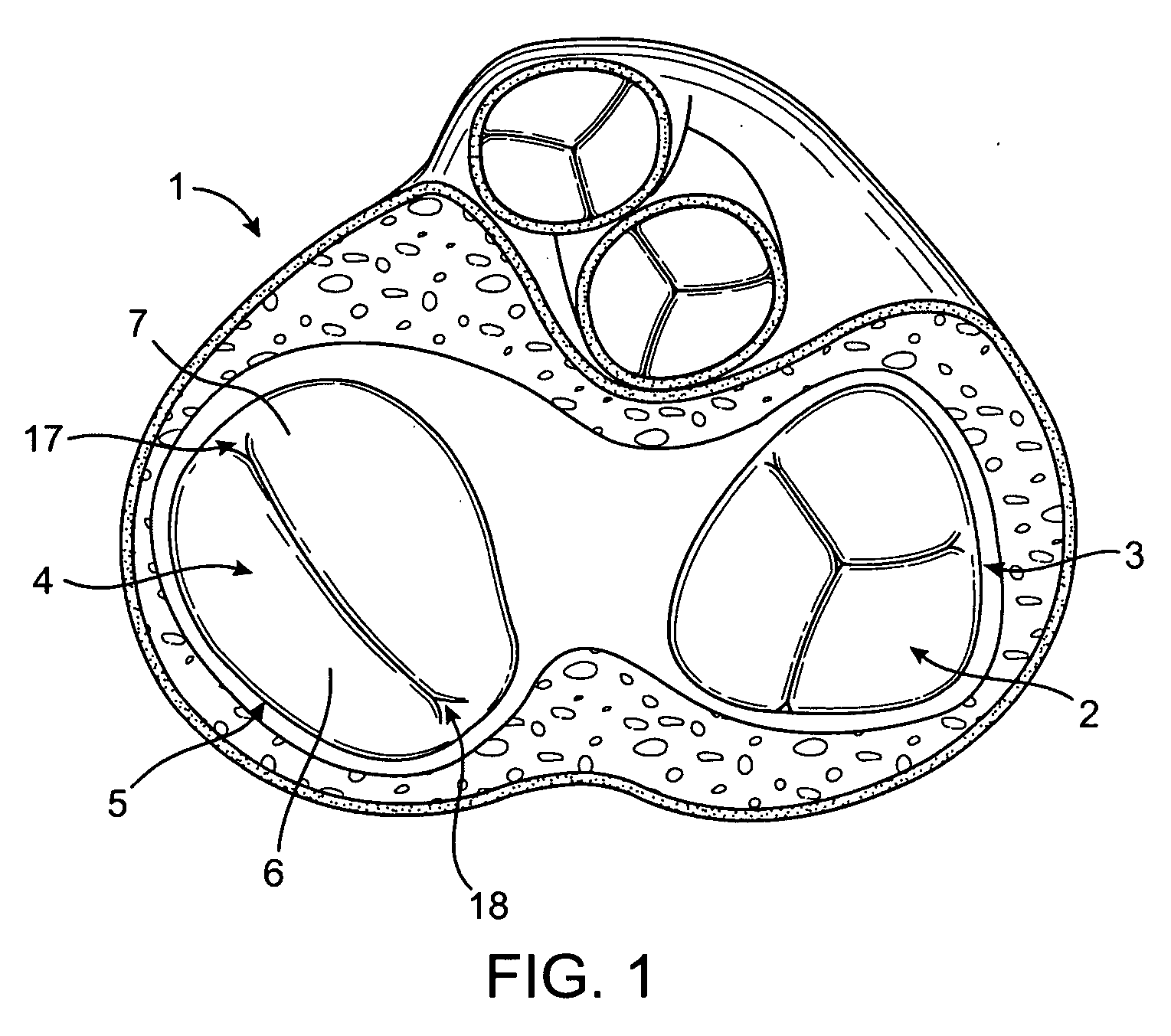 Devices and Methods for Treating Valvular Regurgitation