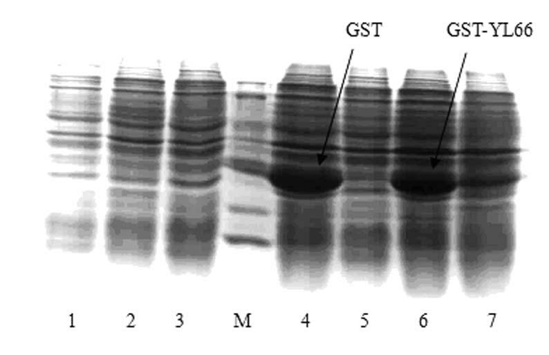 Multi-epitope vaccine YL66 and application of preparing vaccine for treating tumour