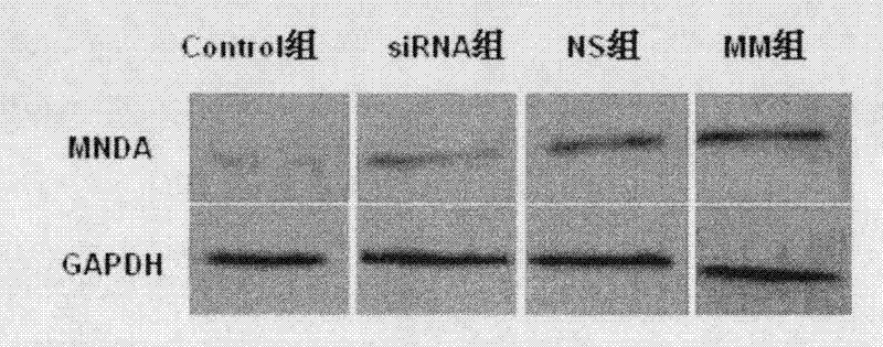 Small RNA for human and rat-homologous NMDA receptor NR2B and application thereof