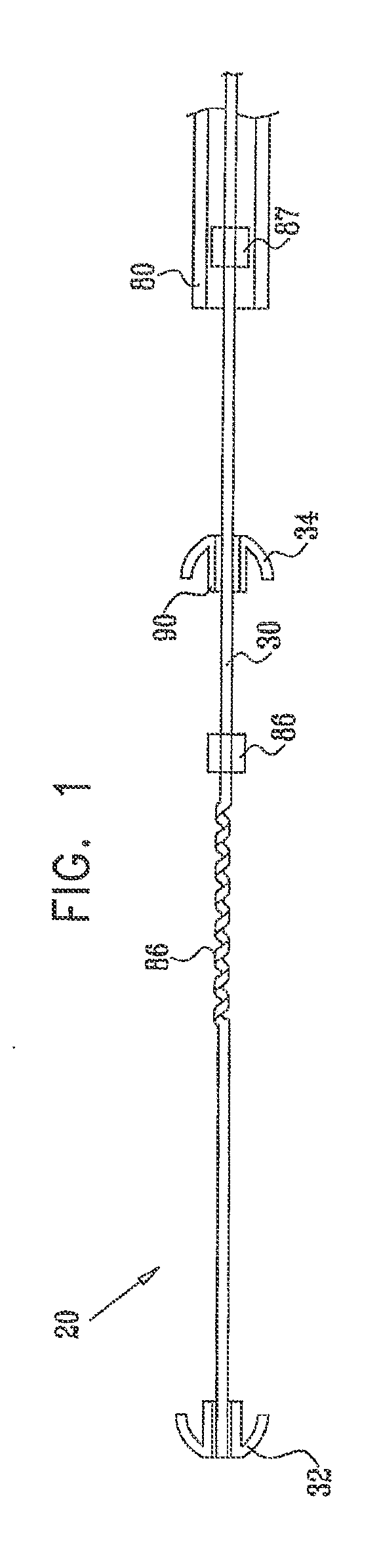 Mitral valve treatment techniques