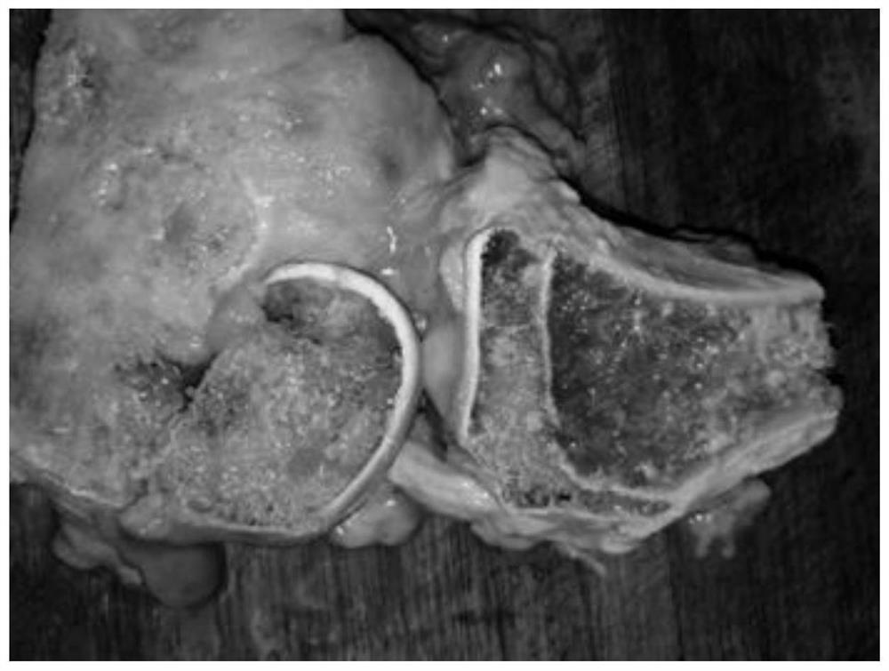 A kind of preparation method and specimen of intraosseous blood vessel anatomy display display specimen