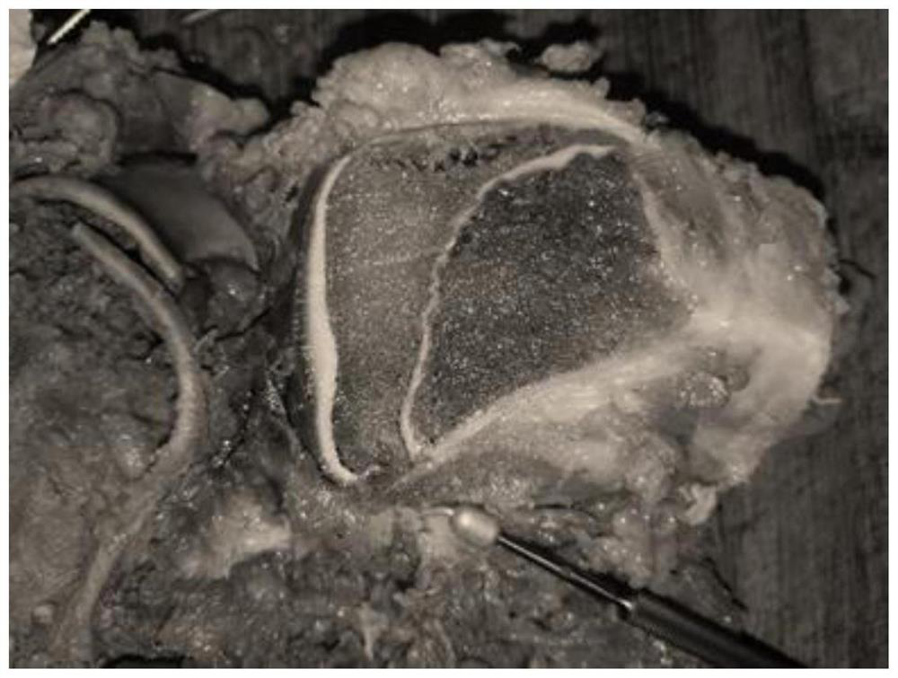 A kind of preparation method and specimen of intraosseous blood vessel anatomy display display specimen